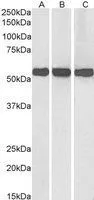 WB analysis of human (A), mouse (B) and rat (C) liver lysate using GTX88164 GLUD1 + GLUD2 antibody, Internall. Dilution : 0.01microg/ml Loading : 35microg protein in RIPA buffer