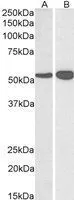 WB analysis of human (A) and mouse (B) brain lysate using GTX88164 GLUD1 + GLUD2 antibody, Internal. Dilution : 0.03microg/ml Loading : 35microg protein in RIPA buffer