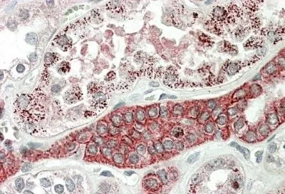 IHC-P analysis of human kidney using GTX88168 DCUN1D1 antibody, C-term. Antigen retrieval : citrate buffer pH 6 Dilution : 5microg/ml IHC-P analysis of human kidney using GTX88168 DCUN1D1 antibody, C-term. Antigen retrieval : citrate buffer pH 6 Dilution : 5microg/ml