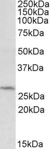 WB analysis of HepG2 lysate using GTX88168 DCUN1D1 antibody, C-term. Dilution : 0.5microg/ml Loading : 35microg protein in RIPA buffer