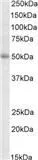 WB analysis of K562 lysate using GTX88170 TRIP6 antibody, Internal. Dilution : 2microg/ml Loading : 35microg protein in RIPA buffer WB analysis of K562 lysate using GTX88170 TRIP6 antibody, Internal. Dilution : 2microg/ml Loading : 35microg protein in RIPA buffer