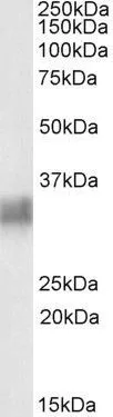 WB analysis of human spleen lysate using GTX88171 CD317 antibody, Internal. Dilution : 0.3microg/ml Loading : 35microg protein in RIPA buffer WB analysis of human spleen lysate using GTX88171 CD317 antibody, Internal. Dilution : 0.3microg/ml Loading : 35microg protein in RIPA buffer