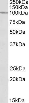 WB analysis of HeLa lysate using GTX88176 CLCN2 antibody, Internal. Dilution : 0.3microg/ml Loading : 35microg protein in RIPA buffer
