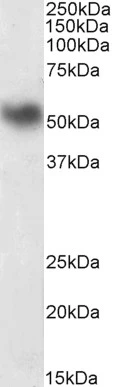 WB analysis of mouse spleen lysate (35microg protein in RIPA buffer) using GTX88185 LSP1 antibody, C-term. Dilution : 0.01microg/ml