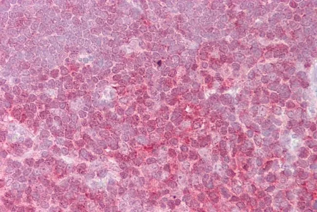 IHC-P analysis of human thymus using GTX88187 c-Rel antibody, Internal. Antigen retrieval : citrate buffer pH 6 Dilution : 2.5microg/ml