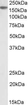 WB analysis of A549 lysate using GTX88191 EVI1 antibody, Internal. Dilution : 2microg/ml Loading : 35microg protein in RIPA buffer WB analysis of A549 lysate using GTX88191 EVI1 antibody, Internal. Dilution : 2microg/ml Loading : 35microg protein in RIPA buffer