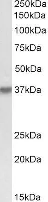 WB analysis of K562 lysate using GTX88192 HSH2D antibody,Internal. Dilution : 0.3ug/ml Loading : 35ug protein in RIPA buffer