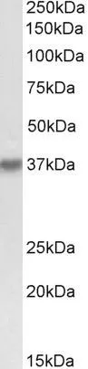WB analysis of K562 lysate using GTX88192 HSH2D antibody, Internal. Dilution : 0.3microg/ml Loading : 35microg protein in RIPA buffer WB analysis of K562 lysate using GTX88192 HSH2D antibody, Internal. Dilution : 0.3microg/ml Loading : 35microg protein in RIPA buffer