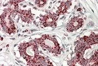 IHC-P analysis of human breast using GTX88196 Aconitase 2 antibody,Internal. Antigen retrieval : citrate buffer pH 6 Dilution : 3.8ug/ml