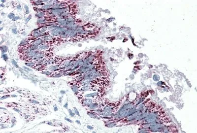 IHC-P analysis of human bronchus using GTX88203 TTLL4 antibody, Internal. Antigen retrieval : citrate buffer pH 6 Dilution : 5microg/ml IHC-P analysis of human bronchus using GTX88203 TTLL4 antibody, Internal. Antigen retrieval : citrate buffer pH 6 Dilution : 5microg/ml
