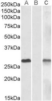 WB analysis of HEK293 overexpressing human DYDC1 lysate with C-terminal MYC tag using GTX88205 DYDC1 antibody, Internal. Lane A : primary antibody Lane B : Mock-transfected HEK293 probed with primary antibody Lane C : Tag antibody Dilution : 1microg/ml Loading : 10microg protein in RIPA buffer WB analysis of HEK293 overexpressing human DYDC1 lysate with C-terminal MYC tag using GTX88205 DYDC1 antibody, Internal. Lane A : primary antibody Lane B : Mock-transfected HEK293 probed with primary antibody Lane C : Tag antibody Dilution : 1microg/ml Loading : 10microg protein in RIPA buffer