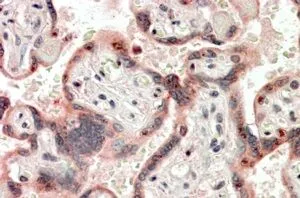 IHC-P analysis of human placenta using GTX88209 Cripto antibody, Internal. Antigen retrieval : citrate buffer pH 6 Dilution : 3.8microg/ml IHC-P analysis of human placenta using GTX88209 Cripto antibody, Internal. Antigen retrieval : citrate buffer pH 6 Dilution : 3.8microg/ml
