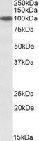 WB analysis of NIH-3T3 lysate using GTX88211 SEC23A antibody, Internal. Dilution : 2microg/ml Loading : 35microg protein in RIPA buffer WB analysis of NIH-3T3 lysate using GTX88211 SEC23A antibody, Internal. Dilution : 2microg/ml Loading : 35microg protein in RIPA buffer