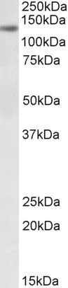 WB analysis of NIH-3T3 lysate using GTX88212 DIAPH1 antibody, Internal. Dilution : 0.3microg/ml Loading : 35microg protein in RIPA buffer WB analysis of NIH-3T3 lysate using GTX88212 DIAPH1 antibody, Internal. Dilution : 0.3microg/ml Loading : 35microg protein in RIPA buffer
