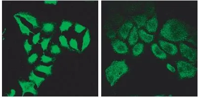 ICC/IF analysis of methanol-fixed HeLa before (left) and after (right) introduction of siRNA using GTX88225 SPARTIN antibody, Internal. Dilution : 2microg/ml