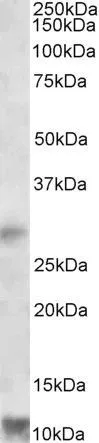 WB analysis of human heart lysate using GTX88232 RNF7 antibody, Internal. Dilution : 1microg/ml Loading : 35microg protein in RIPA buffer WB analysis of human heart lysate using GTX88232 RNF7 antibody, Internal. Dilution : 1microg/ml Loading : 35microg protein in RIPA buffer