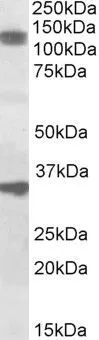 WB analysis of rat skeletal muscle lysate using GTX88234 CCAR1 antibody, Internal (near C-Terminus). Dilution : 1microg/ml Loading : 35microg protein in RIPA buffer WB analysis of rat skeletal muscle lysate using GTX88234 CCAR1 antibody, Internal (near C-Terminus). Dilution : 1microg/ml Loading : 35microg protein in RIPA buffer