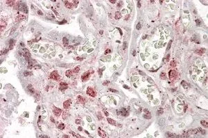 IHC-P analysis of human placenta using GTX88235 MLX antibody, Internal. Antigen retrieval : citrate buffer pH 6 Dilution : 3.8microg/ml IHC-P analysis of human placenta using GTX88235 MLX antibody, Internal. Antigen retrieval : citrate buffer pH 6 Dilution : 3.8microg/ml