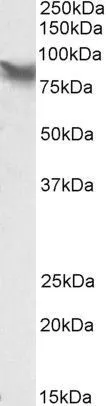 WB analysis of HepG2 lysate using GTX88236 LPP antibody,Internal. Dilution : 0.1ug/ml Loading : 35ug protein in RIPA buffer