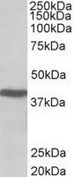 WB analysis of mouse liver lysate using GTX88247 ACAT1 (aa253-266) antibody, Internal. Dilution : 0.01microg/ml Loading : 35microg protein in RIPA buffer WB analysis of mouse liver lysate using GTX88247 ACAT1 (aa253-266) antibody, Internal. Dilution : 0.01microg/ml Loading : 35microg protein in RIPA buffer