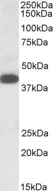 WB analysis of K562 lysate using GTX88249 A4GNT antibody, C-term. Dilution : 1microg/ml Loading : 35microg protein in RIPA buffer WB analysis of K562 lysate using GTX88249 A4GNT antibody, C-term. Dilution : 1microg/ml Loading : 35microg protein in RIPA buffer
