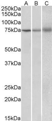 WB analysis of human (A), mouse (B) and rat (C) spleen lysate using GTX88252 KLHL6 antibody, Internal. Dilution : 2microg/ml Loading : 35microg protein in RIPA buffer WB analysis of human (A), mouse (B) and rat (C) spleen lysate using GTX88252 KLHL6 antibody, Internal. Dilution : 2microg/ml Loading : 35microg protein in RIPA buffer