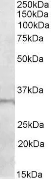WB analysis of human skeletal muscle lysate using GTX88255 E2F6 antibody,C-term. Dilution : 1ug/ml Loading : 35ug protein in RIPA buffer