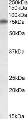 WB analysis of HepG2 lysate using GTX88260 Arginyl tRNA synthetase antibody, Internal. Dilution : 1microg/ml Loading : 35microg protein in RIPA buffer WB analysis of HepG2 lysate using GTX88260 Arginyl tRNA synthetase antibody, Internal. Dilution : 1microg/ml Loading : 35microg protein in RIPA buffer