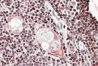 IHC-P analysis of human thymus using GTX88290 SATB1 antibody, Internal. Antigen retrieval : citrate buffer pH 6 Dilution : 3.8microg/ml