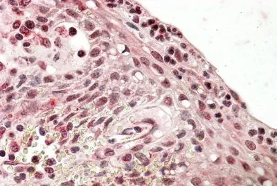 IHC-P analysis of human tonsil using GTX88296 Blimp1 antibody, Internal. Antigen retrieval : citrate buffer pH 6 Dilution : 3.8microg/ml IHC-P analysis of human tonsil using GTX88296 Blimp1 antibody, Internal. Antigen retrieval : citrate buffer pH 6 Dilution : 3.8microg/ml