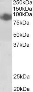 WB analysis of A431 lysate using GTX88296 Blimp1 antibody, Internal. Dilution : 0.5microg/ml Loading : 35microg protein in RIPA buffer