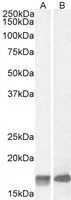 WB analysis of mouse (A) and rat (B) brain lysate using GTX88303 Galanin antibody, Internal. Dilution : 2microg/ml Loading : 35microg protein in RIPA buffer