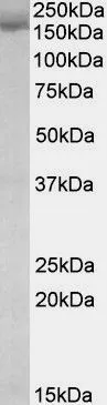 WB analysis of K562 lysate using GTX88304 SA2 antibody, Internal. Dilution : 0.03microg/ml Loading : 35microg protein in RIPA buffer WB analysis of K562 lysate using GTX88304 SA2 antibody, Internal. Dilution : 0.03microg/ml Loading : 35microg protein in RIPA buffer