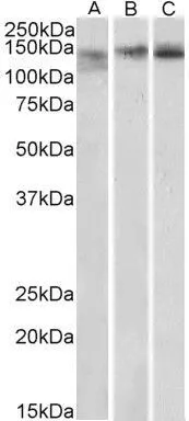 WB analysis of mouse spleen (A), mouse thymus (B) and rat spleen (C) lysates using GTX88304 SA2 antibody, Internal. Dilution : 0.3microg/ml Loading : 35microg protein in RIPA buffer