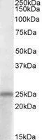WB analysis of human hippocampus lysate using GTX88313 PACAP antibody, C-term. Dilution : 1microg/ml Loading : 35microg protein in RIPA buffer WB analysis of human hippocampus lysate using GTX88313 PACAP antibody, C-term. Dilution : 1microg/ml Loading : 35microg protein in RIPA buffer