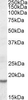 WB analysis of human heart lysate using GTX88326 HMGA2 antibody, Internal. Dilution : 1microg/ml Loading : 35microg protein in RIPA buffer WB analysis of human heart lysate using GTX88326 HMGA2 antibody, Internal. Dilution : 1microg/ml Loading : 35microg protein in RIPA buffer