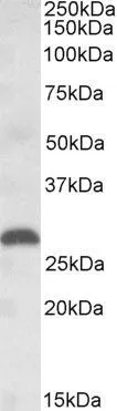 WB analysis of human placenta lysate using GTX88328 PLGF antibody, Internal. Dilution : 1microg/ml Loading : 35microg protein in RIPA buffer WB analysis of human placenta lysate using GTX88328 PLGF antibody, Internal. Dilution : 1microg/ml Loading : 35microg protein in RIPA buffer