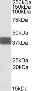 WB analysis of human brain cerebellum lysate using GTX88330 WNT9B antibody, Internal. Dilution : 0.3microg/ml Loading : 35microg protein in RIPA buffer WB analysis of human brain cerebellum lysate using GTX88330 WNT9B antibody, Internal. Dilution : 0.3microg/ml Loading : 35microg protein in RIPA buffer