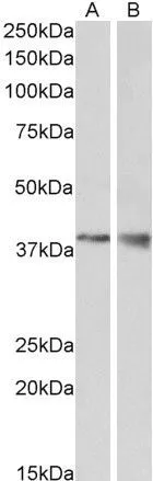 WB analysis of mouse kidney (A) and brain (B) lysate using GTX88330 WNT9B antibody, Internal. Dilution : 1microg/ml Loading : 35microg protein in RIPA buffer