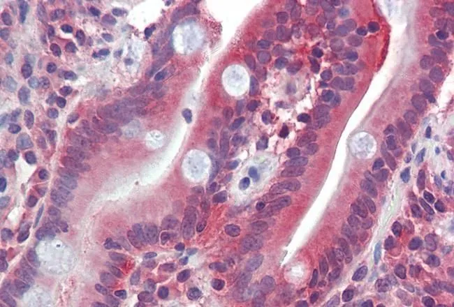 IHC-P analysis of human small intestine using GTX88331 GLUT5 antibody, C-term. Antigen retrieval : citrate buffer pH 6 Dilution : 2.5microg/ml IHC-P analysis of human small intestine using GTX88331 GLUT5 antibody, C-term. Antigen retrieval : citrate buffer pH 6 Dilution : 2.5microg/ml