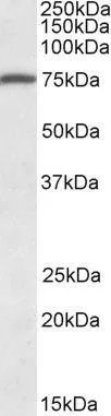 WB analysis of human peripheral blood mononucleocytes lysate using GTX88332 URP2 antibody, C-term. Dilution : 1microg/ml Loading : 35microg protein in RIPA buffer WB analysis of human peripheral blood mononucleocytes lysate using GTX88332 URP2 antibody, C-term. Dilution : 1microg/ml Loading : 35microg protein in RIPA buffer