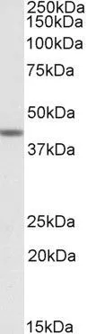 WB analysis of human testis lysate using GTX88345 TAF7L antibody, Internal. Dilution : 1microg/ml Loading : 35microg protein in RIPA buffer WB analysis of human testis lysate using GTX88345 TAF7L antibody, Internal. Dilution : 1microg/ml Loading : 35microg protein in RIPA buffer