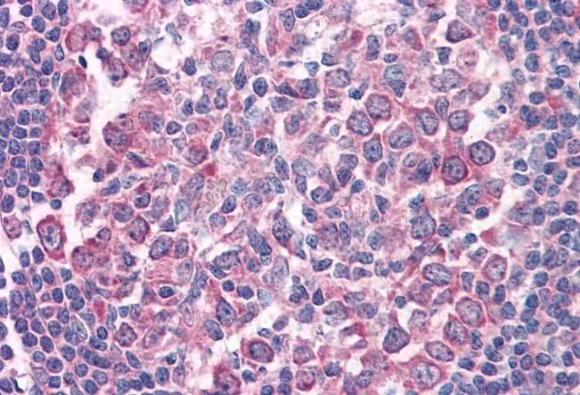 IHC-P analysis of human tonsil using GTX88349 Fas antibody, Internal. Antigen retrieval : citrate buffer pH 6 IHC-P analysis of human tonsil using GTX88349 Fas antibody, Internal. Antigen retrieval : citrate buffer pH 6