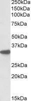 WB analysis of mouse liver lysate using GTX88352 CYB5R3 antibody, C-term. Dilution : 0.1microg/ml Loading : 35microg protein in RIPA buffer WB analysis of mouse liver lysate using GTX88352 CYB5R3 antibody, C-term. Dilution : 0.1microg/ml Loading : 35microg protein in RIPA buffer