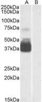 WB analysis of human brain (frontal cortex) lysate with (B) and without (A) blocking with the immunising peptide using GTX88360 P2X7 antibody, N-term. Dilution : 0.3microg/ml Loading : 35microg protein in RIPA buffer WB analysis of human brain (frontal cortex) lysate with (B) and without (A) blocking with the immunising peptide using GTX88360 P2X7 antibody, N-term. Dilution : 0.3microg/ml Loading : 35microg protein in RIPA buffer