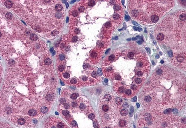 IHC-P analysis of human kidney using GTX88360 P2X7 antibody, N-term. Antigen retrieval : citrate buffer pH 6 Dilution : 3.75microg/ml