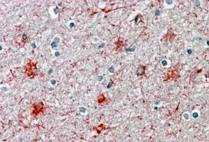 IHC-P analysis of human cortex using GTX88360 P2X7 antibody, N-term. Antigen retrieval : citrate buffer pH 6 Dilution : 3.8microg/ml