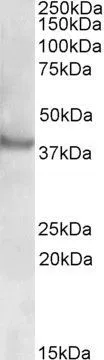 WB analysis of human skeletal muscle lysate using GTX88362 Rapsyn antibody, N-term. Dilution : 0.5microg/ml Loading : 35microg protein in RIPA buffer