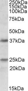 WB analysis of human cerebellum lysate using GTX88363 Podoplanin antibody, Internal. Dilution : 1microg/ml Loading : 35microg protein in RIPA buffer WB analysis of human cerebellum lysate using GTX88363 Podoplanin antibody, Internal. Dilution : 1microg/ml Loading : 35microg protein in RIPA buffer
