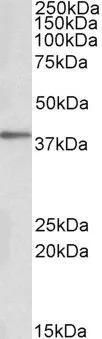 WB analysis of human adipose cell llysate using GTX88367 PRKCDBP antibody, Internal. Dilution : 0.1microg/ml Loading : 35microg protein in RIPA buffer WB analysis of human adipose cell llysate using GTX88367 PRKCDBP antibody, Internal. Dilution : 0.1microg/ml Loading : 35microg protein in RIPA buffer